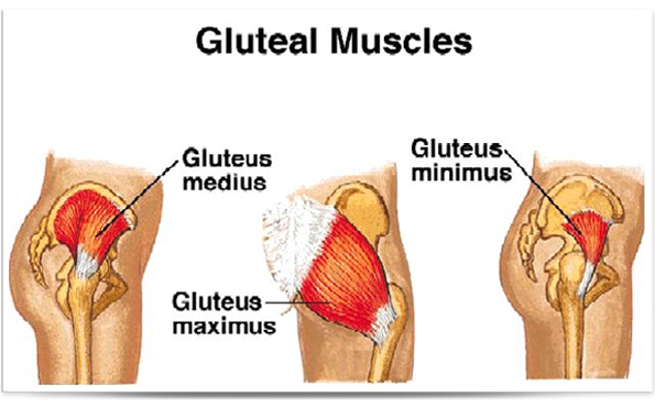 90 Best Can you walk with a torn gluteus medius for Workout Everyday